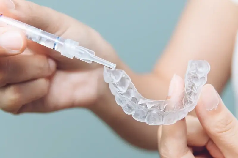 Dlaczego warto wybrać leczenie Invisalign?