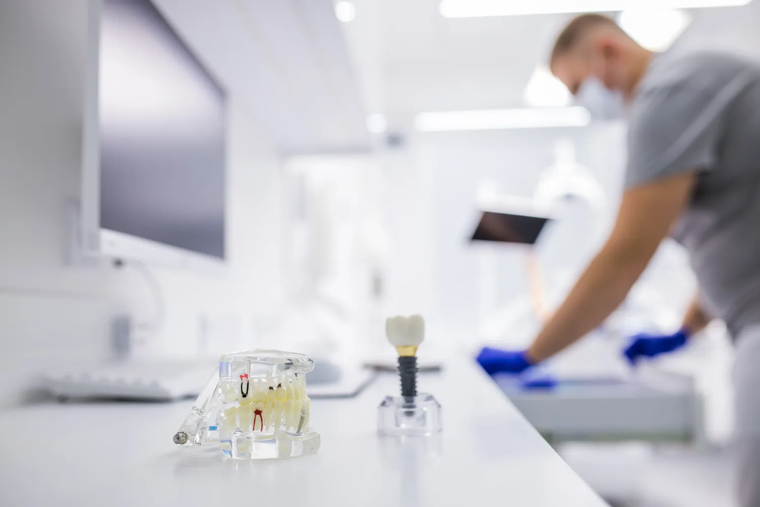 Wszystko co musisz wiedzieć o implantach zębowych