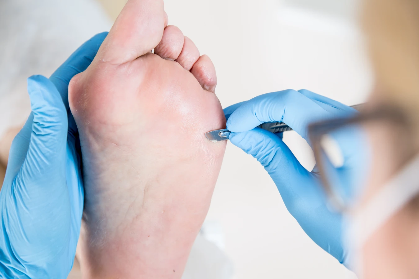 Pedicure podologiczne Szczecin