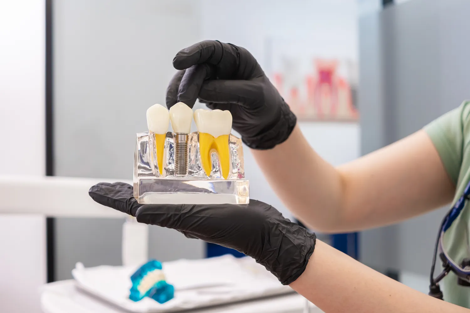 Implanty zębowe Warszawa