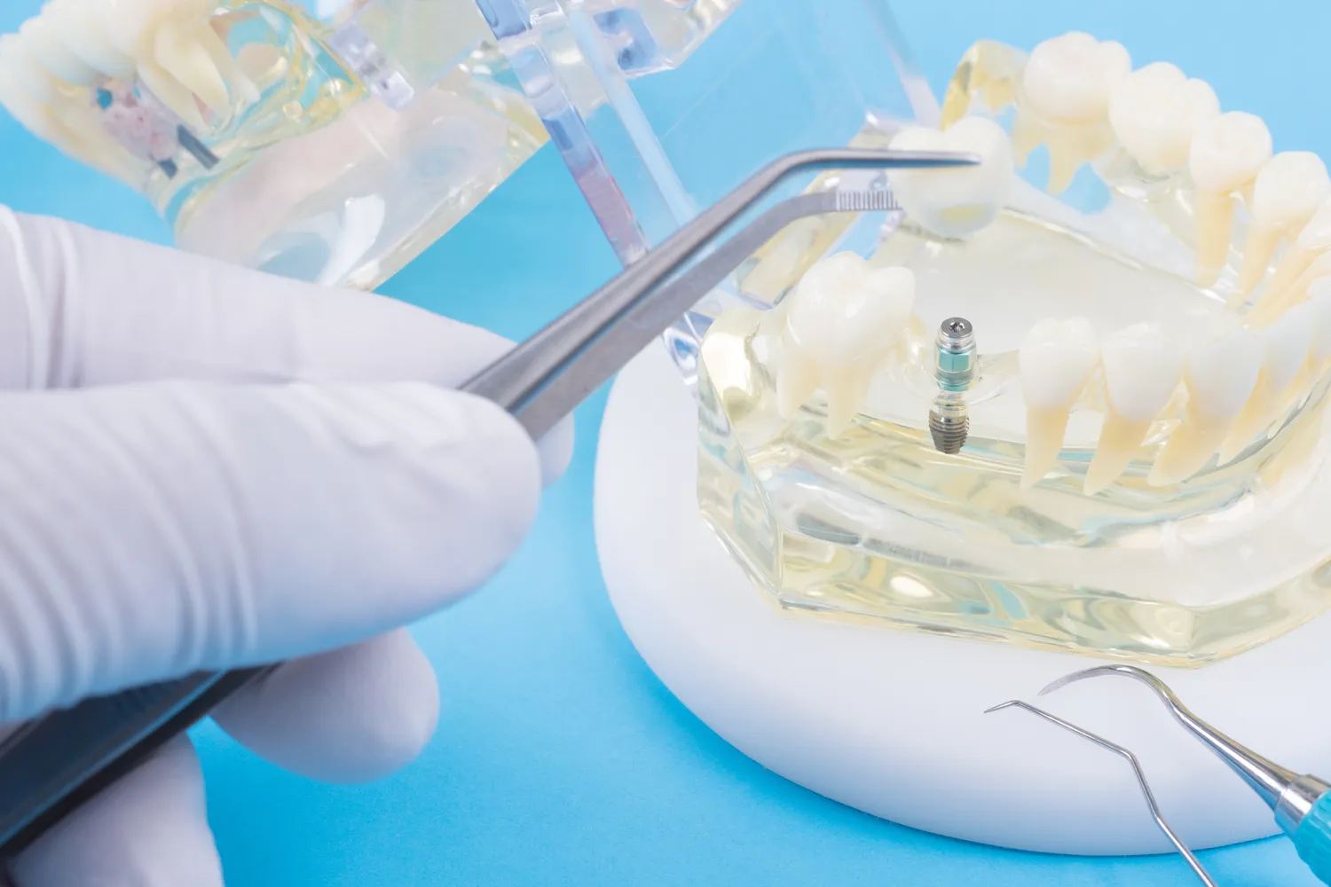 Stomatologia dziecięca Szczecin